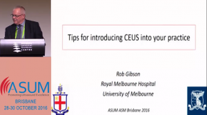 Tips for introducing CEUS into your practice - Prof Robert Gibson