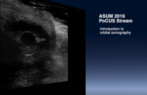 Introduction to orbital sonography - Kylie Baker