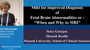 MRI for improved diagnosis of brain abnormalities – including Q&A - Prof Stacy Goergen