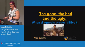 The good, the bad and the ugly; when diagnosis proves difficult - Anne Sutcliffe