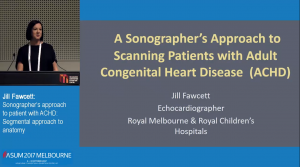 A sonographer’s approach to scanning patients with adult congenital heart disease -  Jill Fawcett