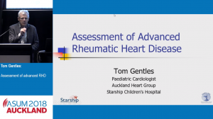 Assessment of advanced RHD - Tom Gentles