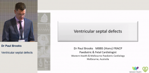 Ventricular septal defects - Dr Paul Brooks