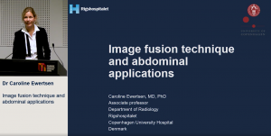 Image fusion technique and abdominal applications - Dr Caroline Ewertson