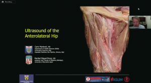 Ultrasound of the anterolateral hip  - Prof Carlo Martinoli