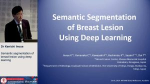 Semantic segmentation of breast lesion using deep learning - Dr Kenichi Inoue