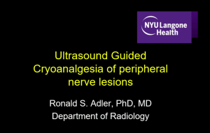 Ultrasound guided cryoanalgesia of peripheral nerve lesions  - Dr Ronald Adler