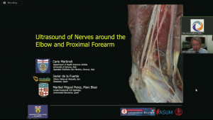Ultrasound of nerves around the elbow and proximal forearm - Prof Carlo Martinoli