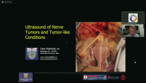 Ultrasound of nerve tumours and tumour-like masses  - Prof Carlo Martinoli