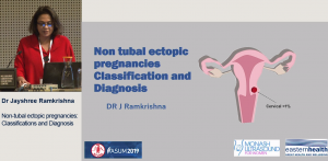 Non-tubal ectopic pregnancies Classification and Diagnosis - Dr Jayshree Ramkrishna