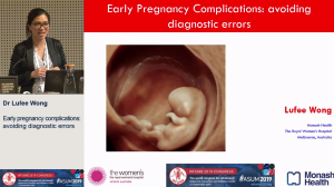 Early pregnancy complications: avoiding diagnostic errors - Dr Lufee Wong
