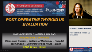 Post-operative thyroid US evaluation - Dr Maria Cristina Chammas