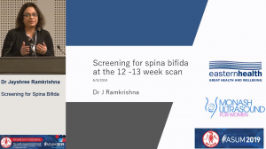 Screening for spina bifida - Dr Jayshree Ramkrishna