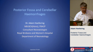 Posterior Fossa and Cerebellar Haemorrhages - Dr Adam Hoellering