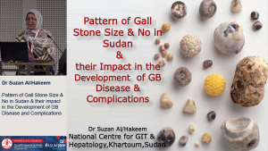Pattern of gall stone (GS) size & number in 1263 otherwise normal Sudanese subjects & their impact in the development of gall bladder disease & complications at the National Centre of Gastroentrology & Hepatology in Sudan during the last 10 years - Dr Susan Alhakeem