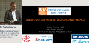 Solid ovarian masses: Lessons and pitfalls - Dr Wouter Froyman