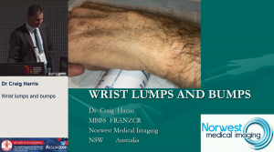 Wrist lumps and bumps  - Dr Craig Harris