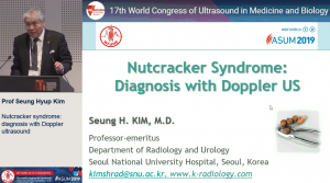 "Nutcracker syndrome: diagnosis  with Doppler ultrasound  - Prof Seung Hyup Kim