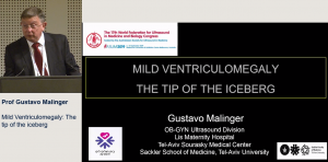 Mild ventriculomegaly: The tip of the iceberg - Prof Gustavo Malinger