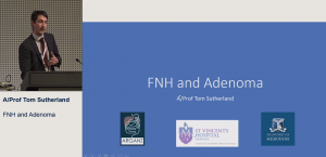 FNH and Adenoma: an update - A/Prof Tom Sutherland