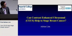 Can CEUS help stage breast cancer? - Prof Adrian Lim