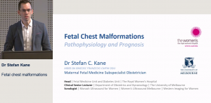 Fetal chest malformations - Dr Stefan Kane