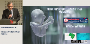 3D reconstruction in fetal medicine - Dr Heron Werner Jr